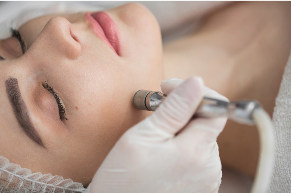 Microdermabrasion